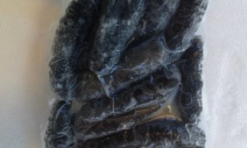 脚淋巴结肿大图片网- 脚上淋巴结肿大是什么原因知识,分享脚淋巴水肿症状有哪些
